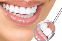 Smile design is a procedure wherein we completely assess and redesign your smile