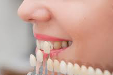 the lifetime value of a brighter smile is hard to calculate