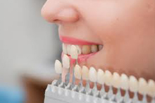 Dental veneers are wafer-thin, custom-made shells of tooth-colored material designed to cover the front surface of teeth